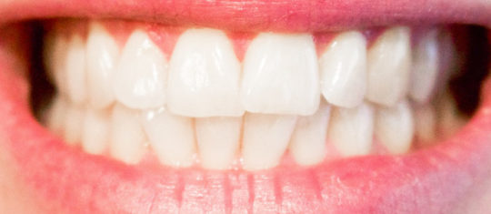 Orthodontie